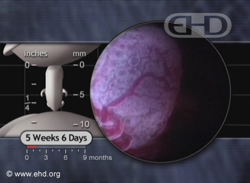 Yolk Sac