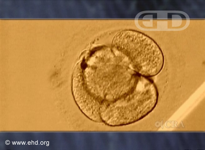 Four-Cell Human Embryo [Click for next image]