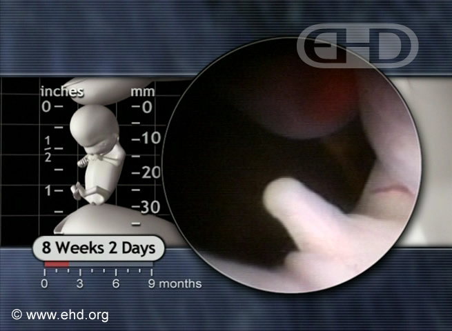 Genital Tubercle