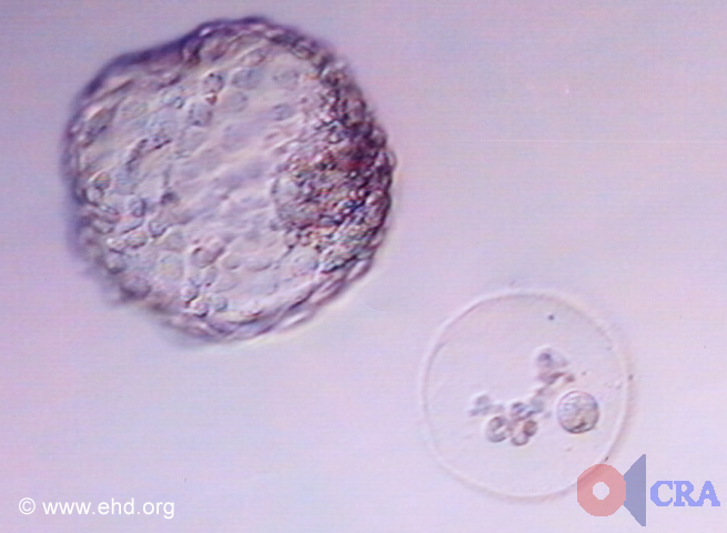 Hatched Blastocyst [Click for next image]