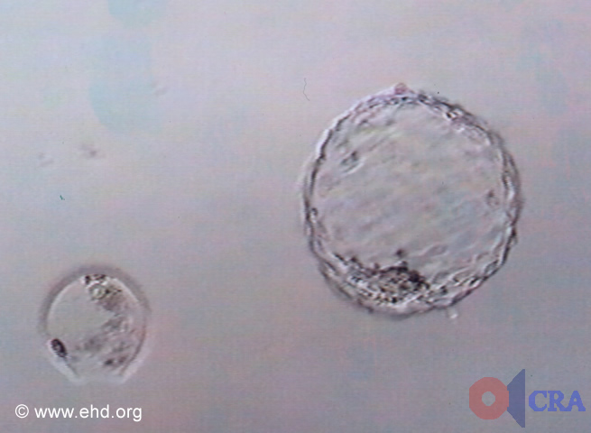 Hatched Blastocyst [Click for next image]