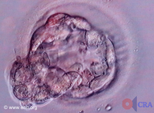 Hatching Blastocyst [Click for next image]