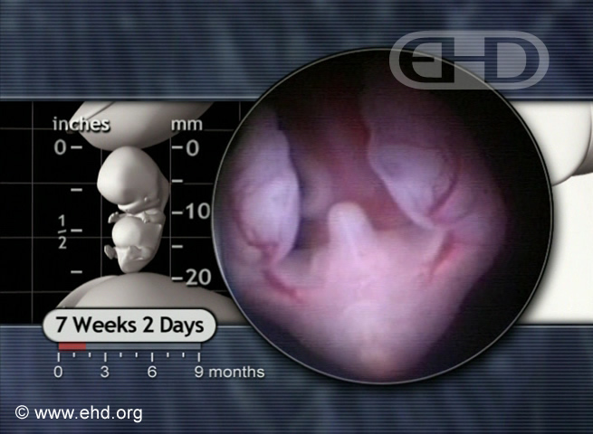 Lower Embryo at 7 Weeks, 2 Days [Click for next image]