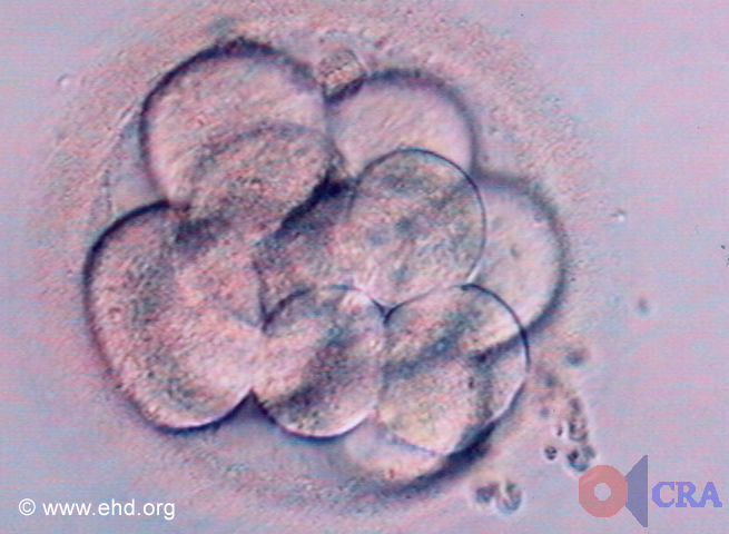 Morula: Twelve-Cell Embryo [Click for next image]