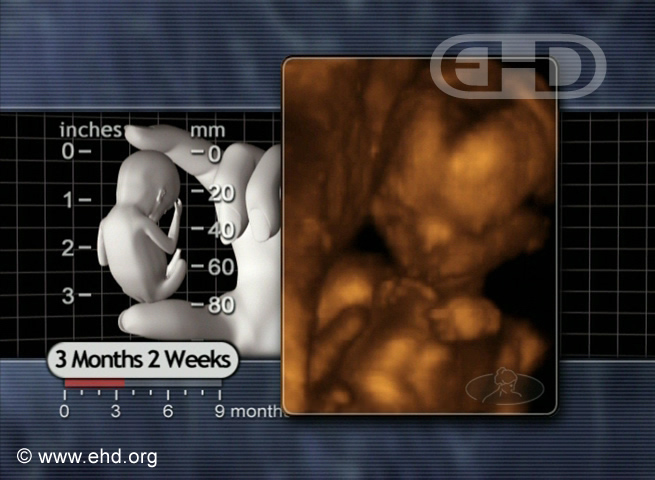 The 14-Week Fetus [Click for next image]