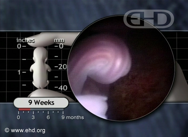 The 9-Week Umbilical Cord [Click for next image]