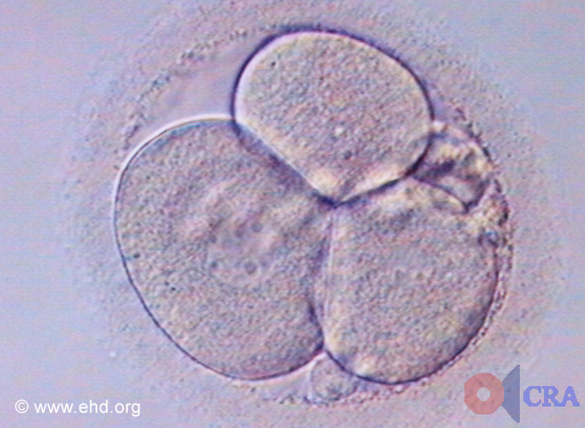 Three-Cell Embryo [Click for next image]